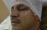 علی دایی دچار سانحه رانندگی شد 