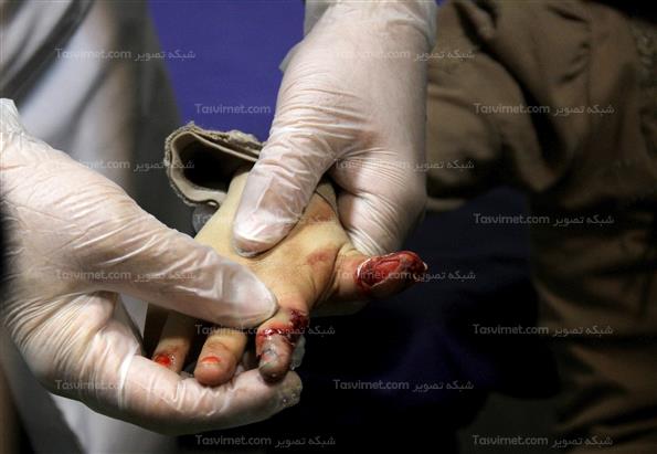 مصدومان چهارشنبه آخر سال