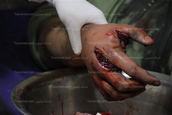 مصدومان چهارشنبه آخرسال