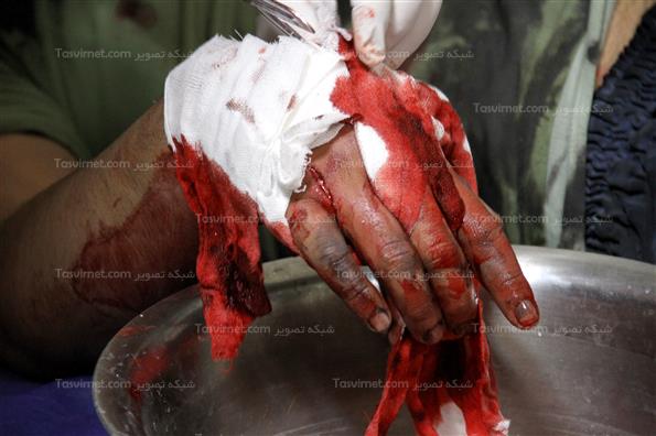 مصدومان چهارشنبه آخرسال