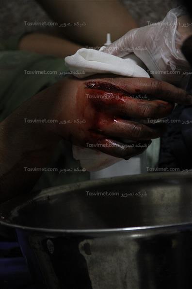 مصدومان چهارشنبه آخرسال