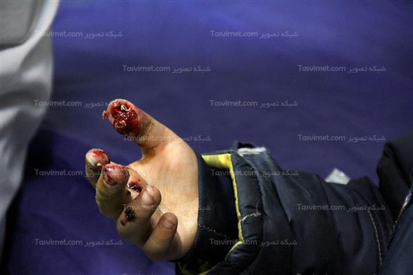 مصدومان چهارشنبه آخر سال