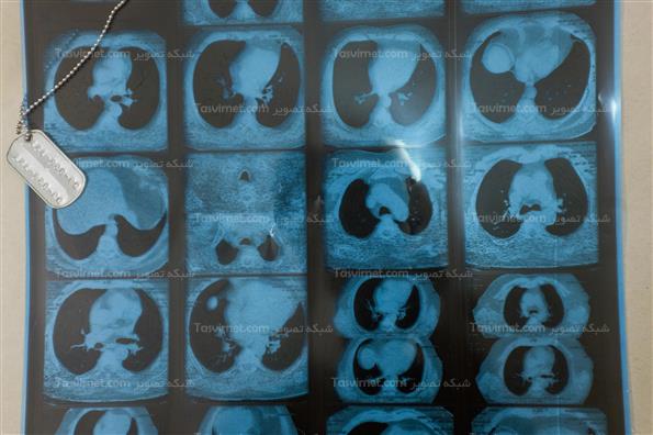 ساعاتی از زندگی یک رزمنده قدیمی